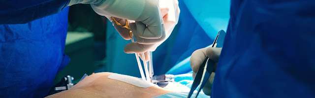 Read more about the article Best Heart Operation Insurance In The United States: A Comprehensive Guide